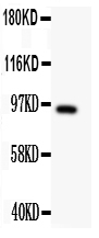 1 - Anti-DISC1 Antibody ABO11330