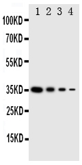 1 - Anti-GCN2 Antibody ABO11335