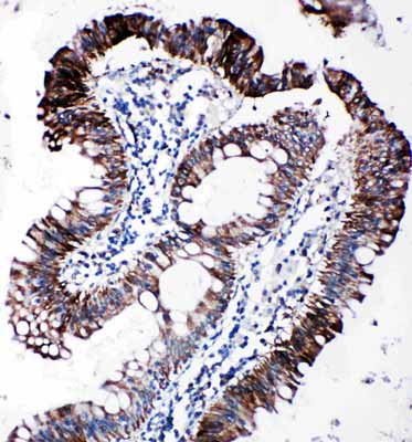 2 - Anti-EIF2S1 Antibody ABO11336
