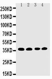 1 - Anti-EIF2S1 Antibody ABO11336