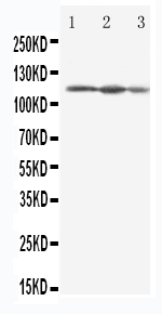 1 - Anti-Eif3b Antibody ABO11337