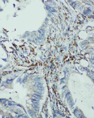 2 - Anti-EIF6 Antibody ABO11338