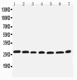 1 - Anti-EIF6 Antibody ABO11338