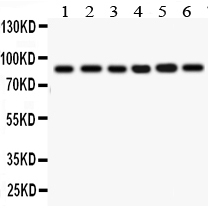 1 - Anti-IKK Beta Antibody ABO11344