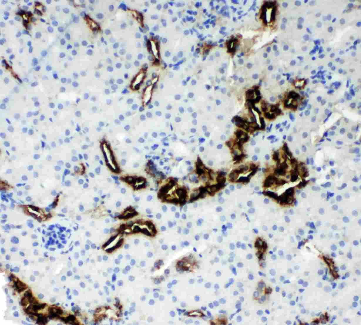 2 - Anti-KLK1 Antibody ABO11346