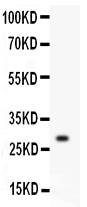 1 - Anti-KLK1 Antibody ABO11346