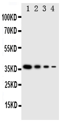 1 - Anti-NTAL Antibody ABO11347