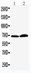 1 - Anti-PADI4/PAD4 Antibody ABO11351