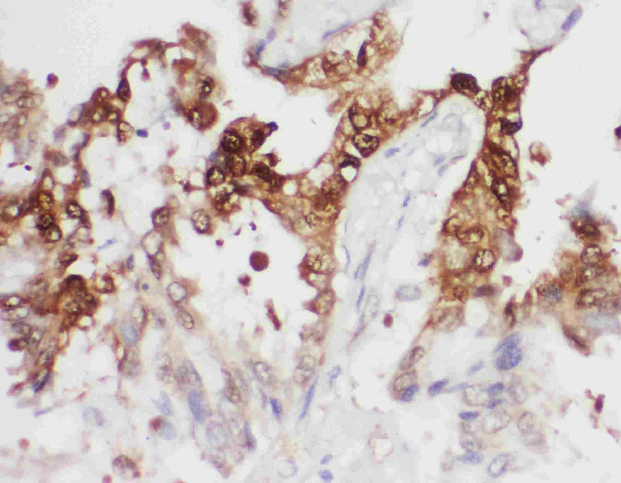 2 - Anti-PGK1 Antibody ABO11352