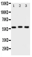 1 - Anti-PKM2 Antibody ABO11353