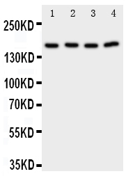 1 - Anti-PLA2G4A Antibody ABO11354
