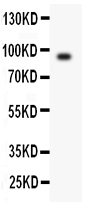 1 - Anti-Periostin/OSF2 Antibody ABO11355