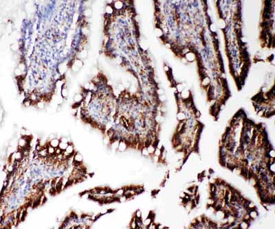 2 - Anti-RGS3 Antibody ABO11358