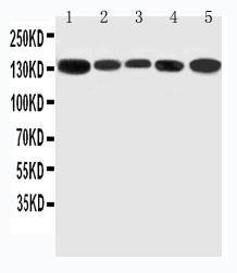 1 - Anti-RGS3 Antibody ABO11358