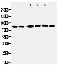 1 - Anti-RSK1 p90 Antibody ABO11360