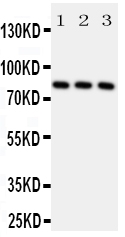 1 - Anti-RSK1 p90 Antibody ABO11360