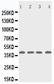 1 - Anti-p53R2 Antibody ABO11361