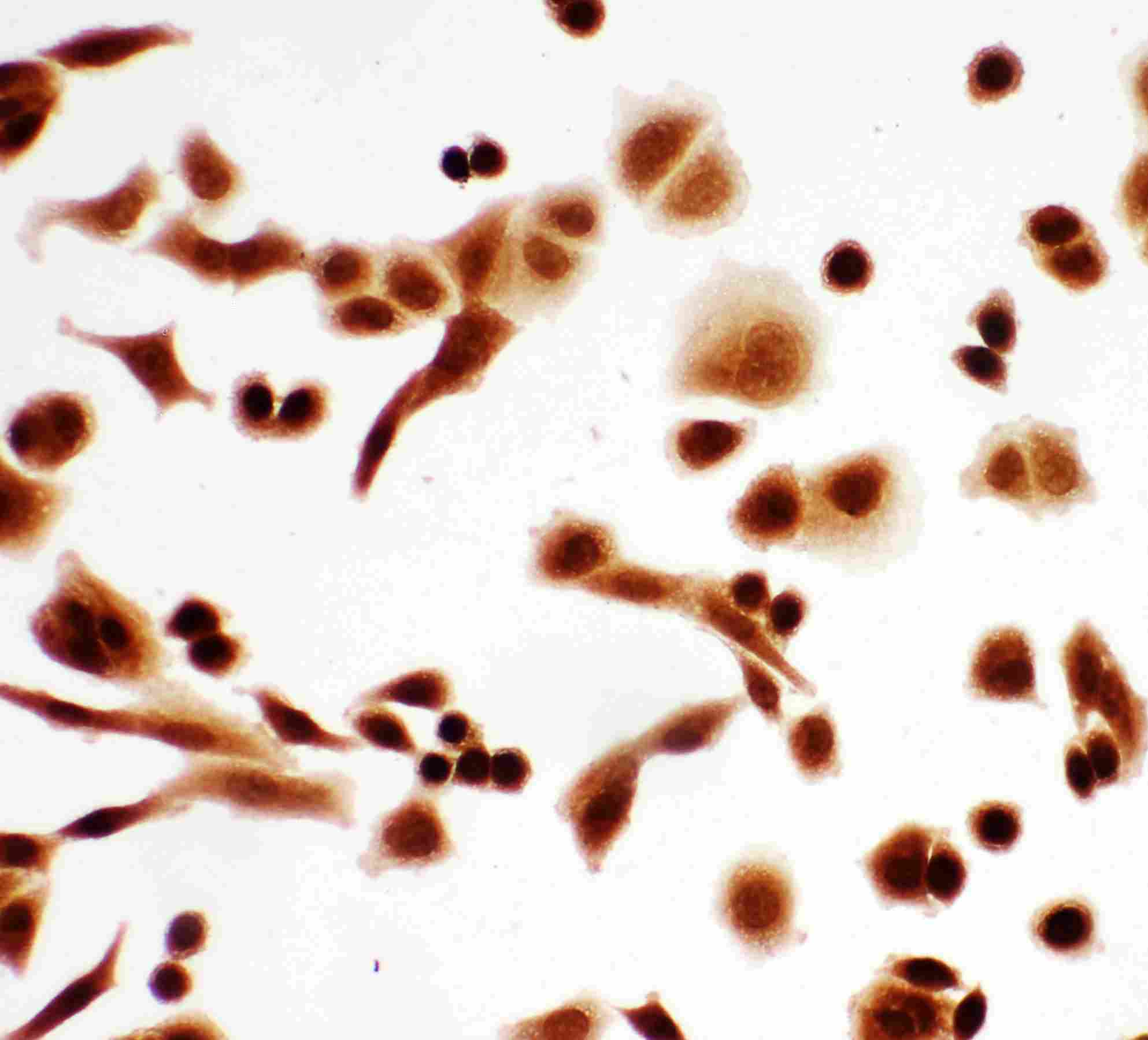 8 - Anti-p63 Antibody ABO11364