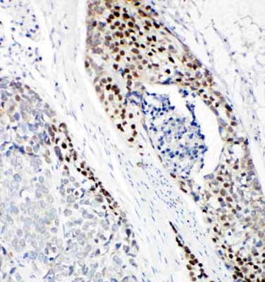 2 - Anti-p63 Antibody ABO11364