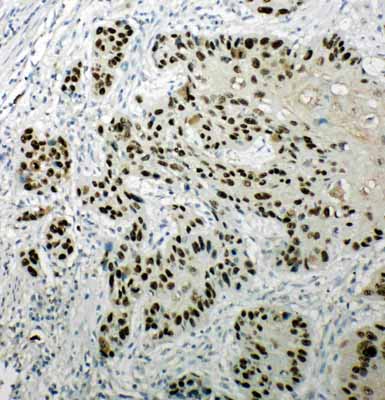 2 - Anti-p63 Antibody ABO11364