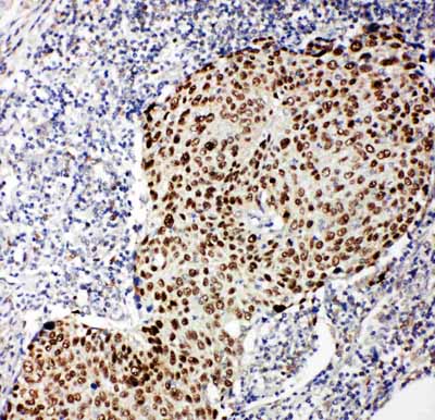2 - Anti-p63 Antibody ABO11364
