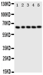 1 - Anti-p63 Antibody ABO11364