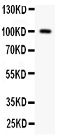 1 - Anti-Prothrombin Antibody ABO11366
