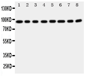 1 - Anti-Factor VIII Antibody ABO11368