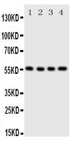 1 - Anti-SLC2A5 Antibody ABO11370