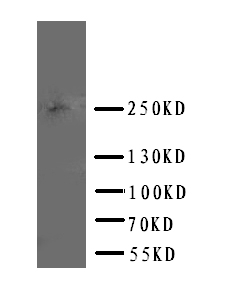 1 - Anti-ABCA4 Antibody ABO11371