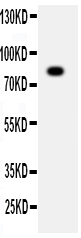 1 - Anti-ADAM2 Antibody ABO11375