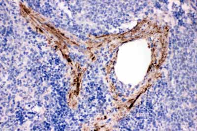 2 - Anti-ADAM19 Antibody ABO11376