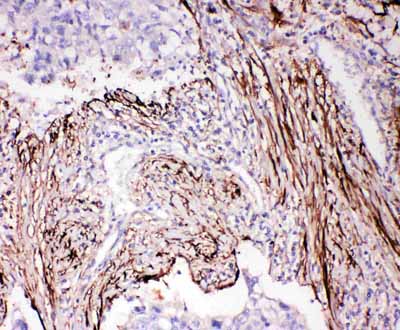 2 - Anti-ADAM19 Antibody ABO11376