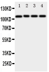 1 - Anti-ADAM19 Antibody ABO11376