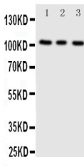 1 - Anti-ADAMTS1 Antibody ABO11377