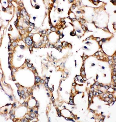 2 - Anti-ALDH2 Antibody ABO11379