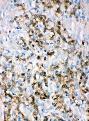 2 - Anti-ALDH3A1 Antibody ABO11380
