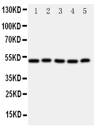 1 - Anti-ALDH3A1 Antibody ABO11380