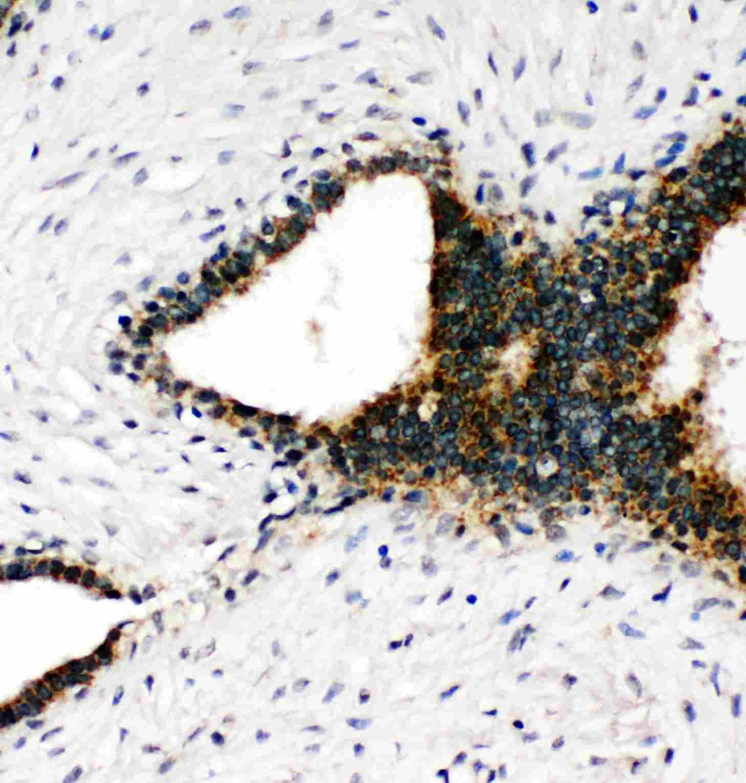 2 - Anti-Annexin VII Antibody ABO11382