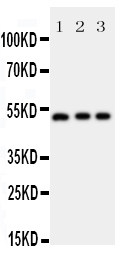 1 - Anti-Annexin VII Antibody ABO11382