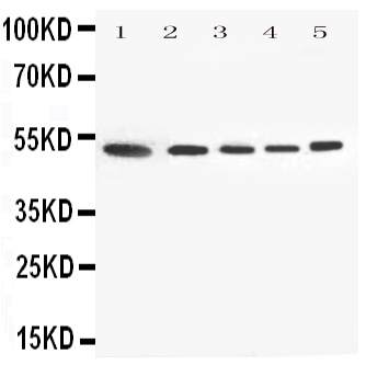 1 - Anti-Annexin VII Antibody ABO11382
