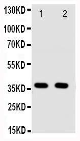 1 - Anti-Annexin A10 Antibody ABO11383