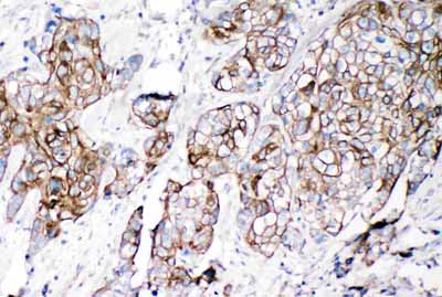 2 - Anti-VE-Cadherin/CD144 Antibody ABO11385