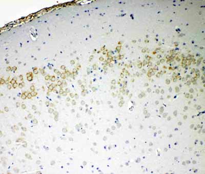 2 - Anti-VE-Cadherin/CD144 Antibody ABO11385