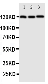 1 - Anti-VE-Cadherin/CD144 Antibody ABO11385