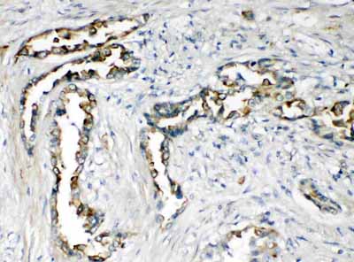 2 - Anti-CXCR1 Antibody ABO11386