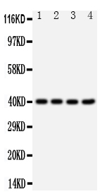 1 - Anti-CXCR1 Antibody ABO11386