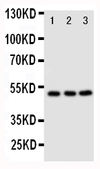 1 - Anti-CXCR4 Antibody ABO11387