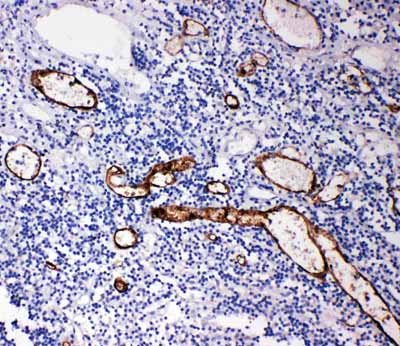 2 - Anti-MADCAM-1 Antibody ABO11390