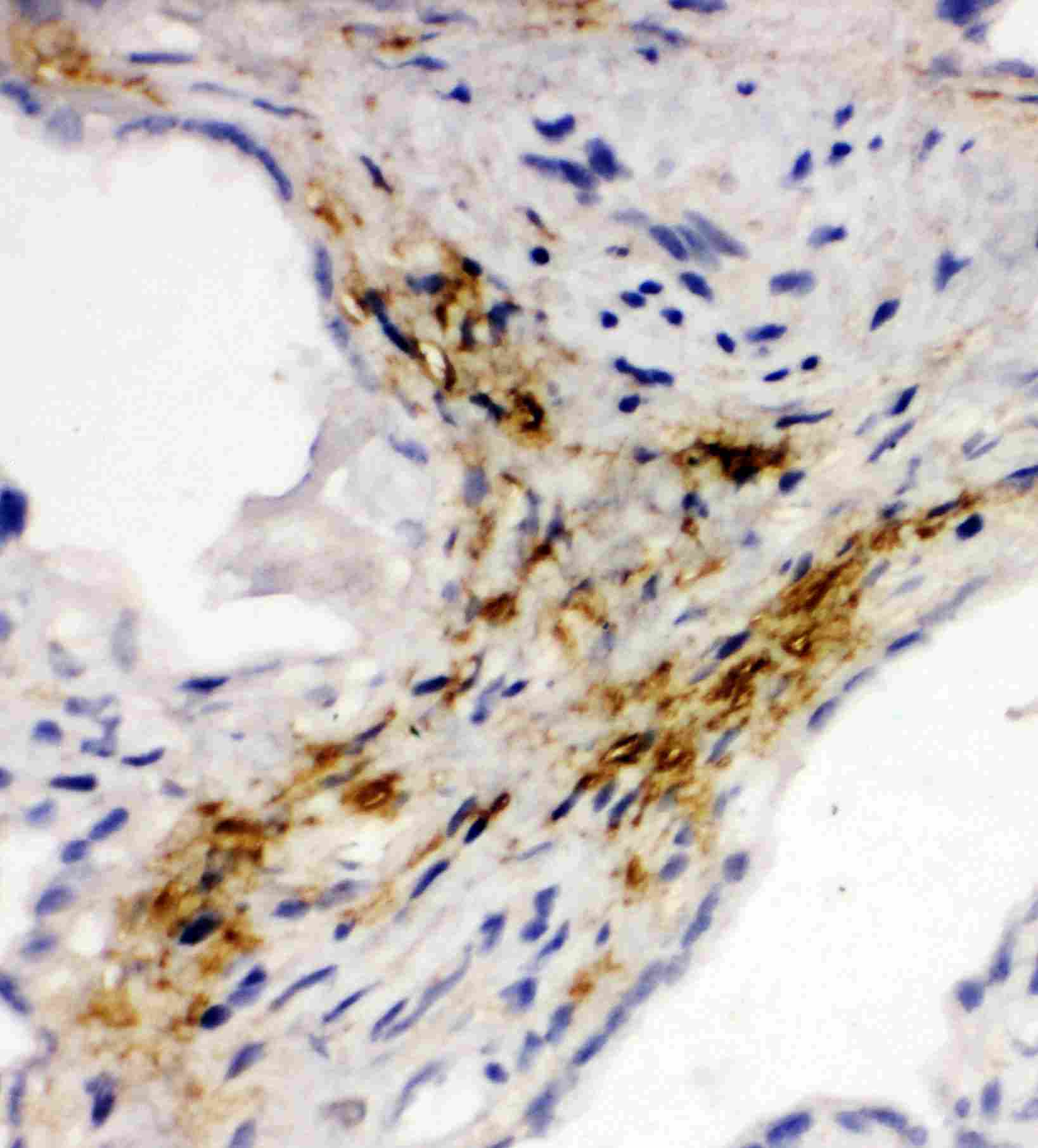 2 - Anti-MADCAM-1 Antibody ABO11390